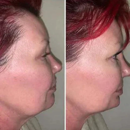 Masajeador Reductor y Rejuvenecedor Facial - SkinTone Pro
