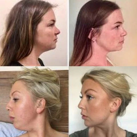 Masajeador Reductor y Rejuvenecedor Facial - SkinTone Pro
