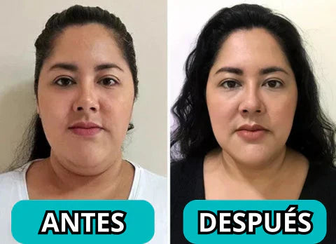 Masajeador Reductor y Rejuvenecedor Facial - SkinTone Pro
