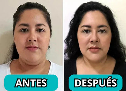 Masajeador Reductor y Rejuvenecedor Facial - SkinTone Pro