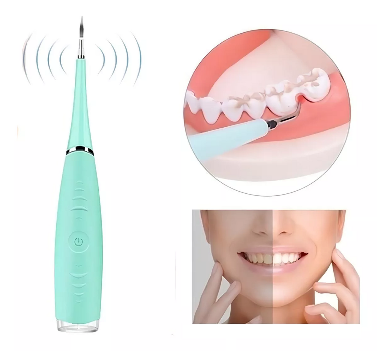 Limpiador Eléctrico Dental Ultrasónico